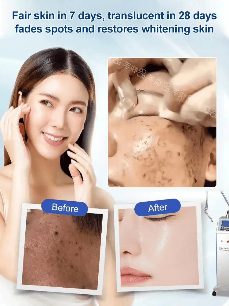 🔥Buy 1 Get 1 Free🔥 Spot Fading Urea Cream
