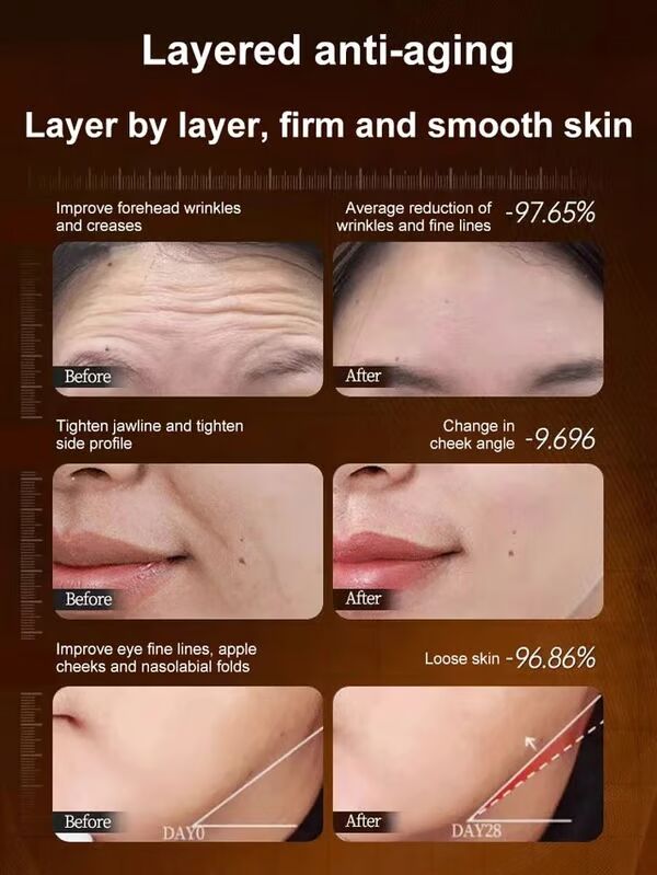 🔥One touch to remove wrinkles🔥Micro-molecular collagen anti-wrinkle lotion