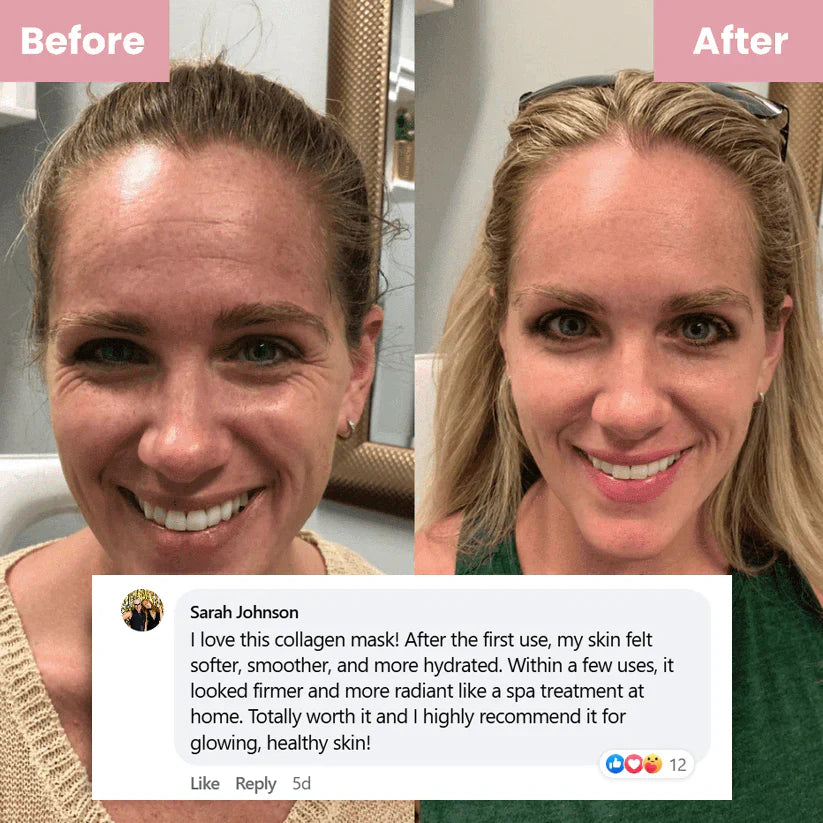 💐Christmas limited edition🏆Pamper Yourself — Buy 2 Collagen Night Masks, Get 1 Free! Wake Up to Youthful, Hydrated Skin!