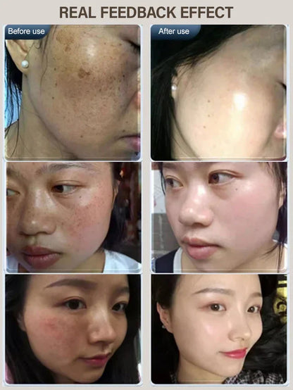 Whitening Blemish Reducing Anti-wrinkle Rejuvenating Mask