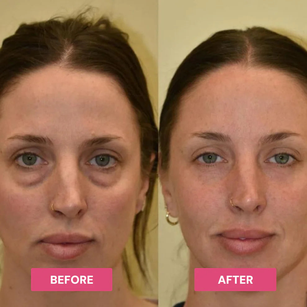 Eye balm visible result