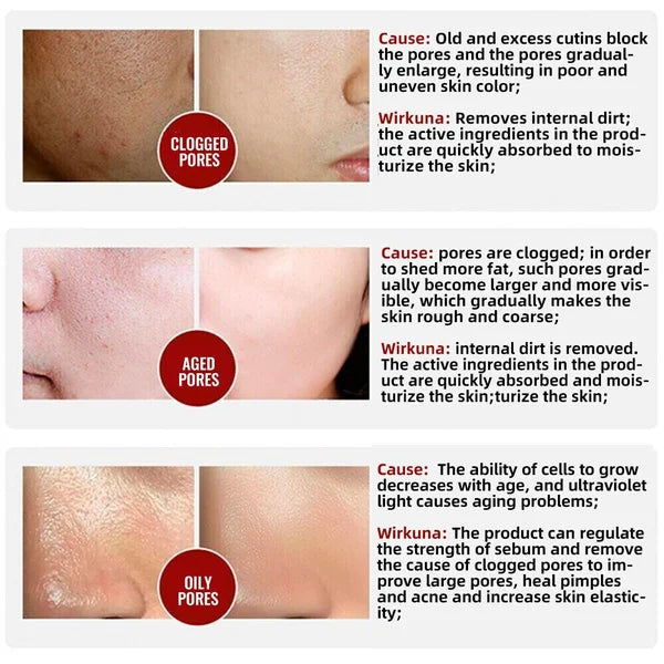 100%Natural&2024 Pore Invisible Cream 🔥 HOT SALE 🔥