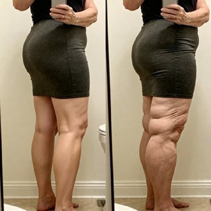 🏆Limited time offer⚡ 50K+ SOLD! Almost Gone-💥Age-Defying Revival Collagen & Stem Cell Body Oil