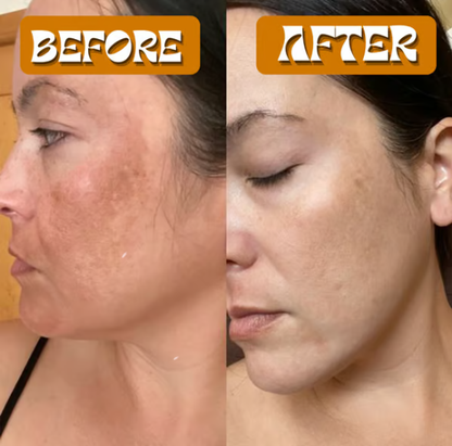 Hoygi Turmeric Cleanser