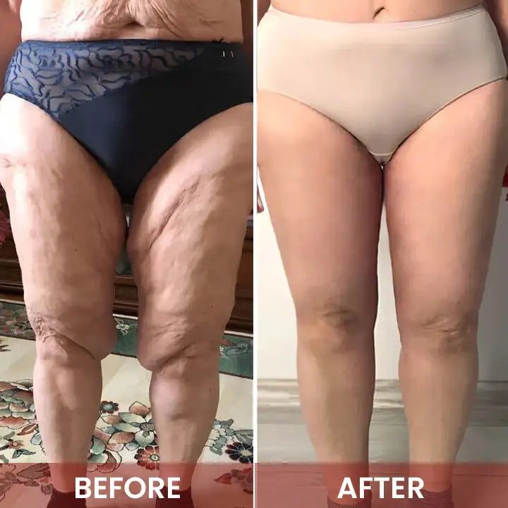 🏆Limited time offer⚡ 50K+ SOLD! Almost Gone-💥Age-Defying Revival Collagen & Stem Cell Body Oil