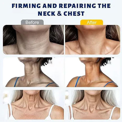 Roller Massage Neck Cream 🧴 Collagen & Hyaluronic Acid | Firms Neck, Reduces Wrinkles & Double Chin