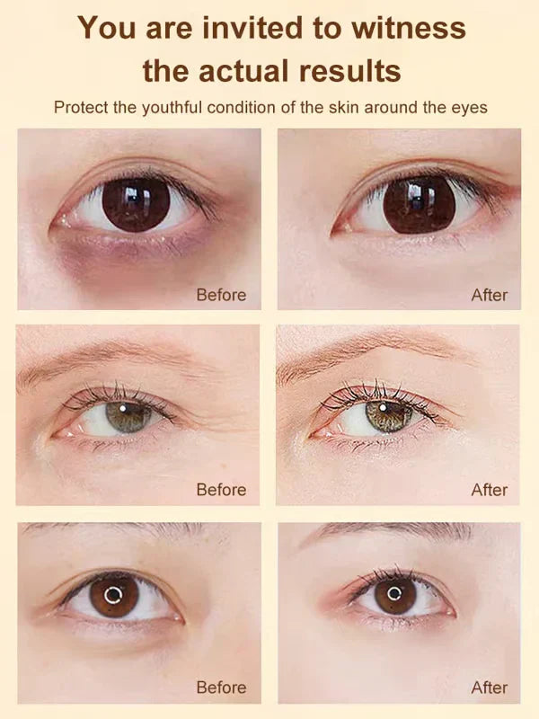 🎁BUY 1 GET 1 FREE🔥 DINKISS LUTEIN EYE ESSENCE OIL