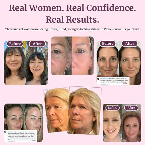 🏆 #1 Bestselling🏆--Cemenrete Calcium Multi Balm 💫 Anti-Aging & Firming Korean Skincare Stick🔥