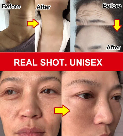 🎁HOT SALE🎁 2025 New Rejuvenating Anti-Wrinkle Cream