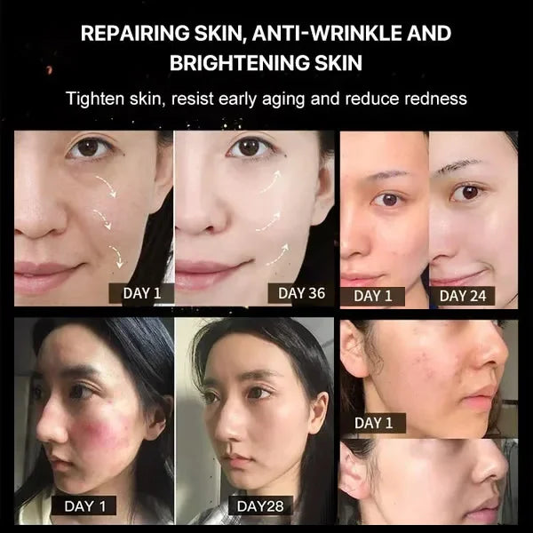 ✨Bee venom facial care ✨Smooth the Look of Wrinkles in 2 minutes — Fast, effective anti-ageing serum — save time and money