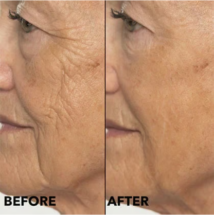 🌟Intense Hydration & Skin Barrier Strength Panthenol Moisturizing Cream