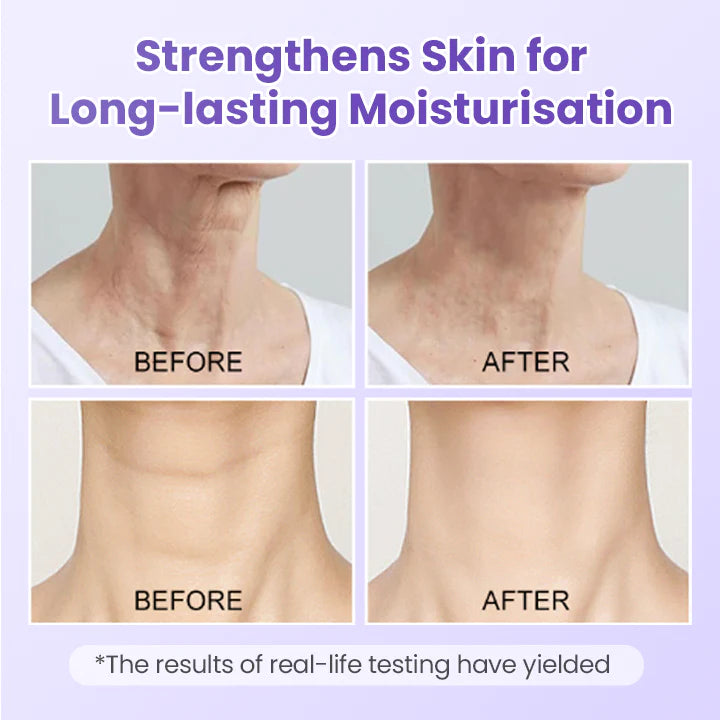 NeckYouth Peptide Anti-Wrinkle Patch