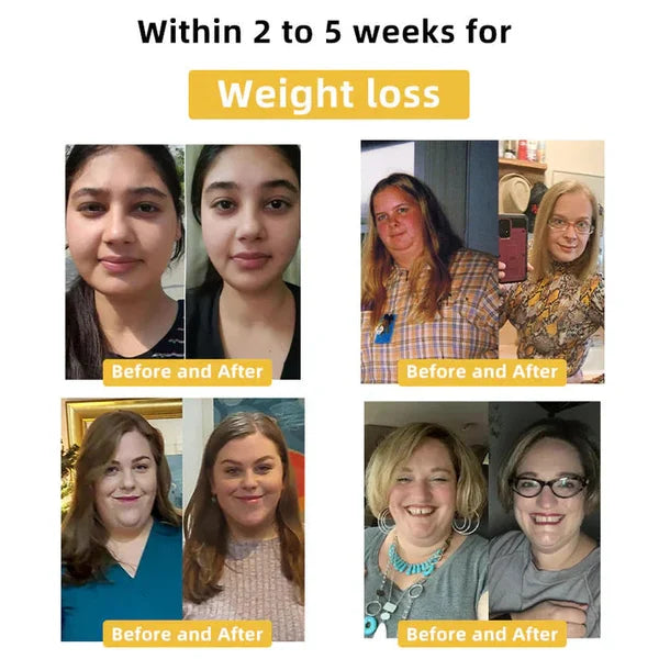 🐝Cvreoz™ Bee Venom Slimming Patch✨ (For all lymphatic problems and obesity)