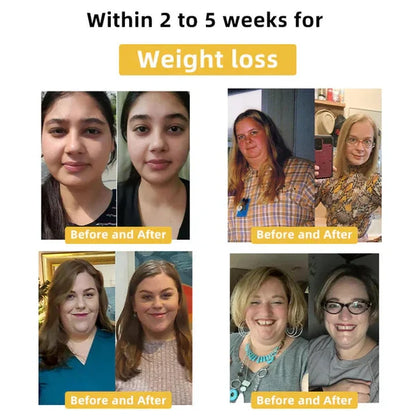 🐝Cvreoz™ Bee Venom Slimming Patch✨ (For all lymphatic problems and obesity)