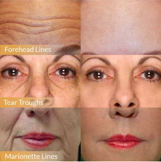 🎁2025 Hot Sale🎁Polypeptide Firming Full Face Cream-CHANGE FOR BEAUTIFUL SKIN WITHIN 2 WEEKS