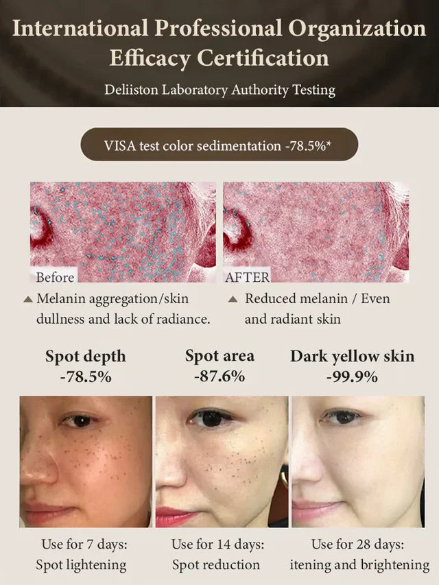 377 WHITENING AND SPOT FADING SERUM