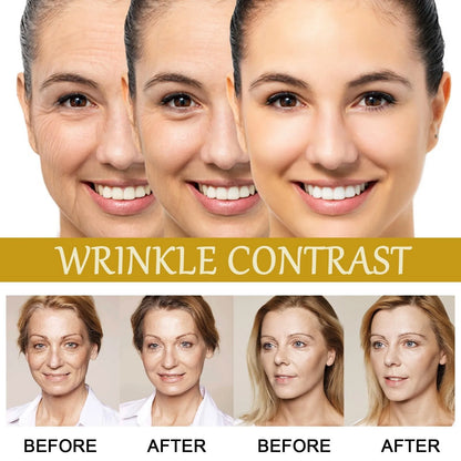 Last Day Promotion 49% OFF - 🔥Bee Venom Anti-Wrinkle Essence