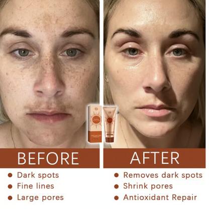 Herbal Spots Peel-Off Facial Mask