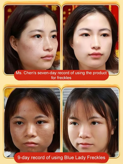 Blemish removal whitening and beauty water