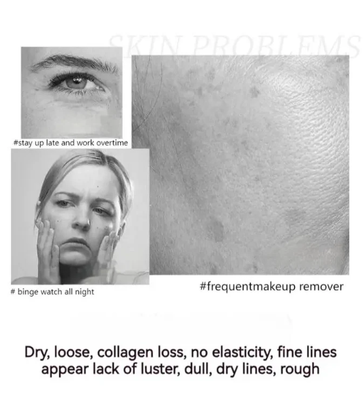 🎁2025 Hot Sale🎁Polypeptide Firming Full Face Cream-CHANGE FOR BEAUTIFUL SKIN WITHIN 2 WEEKS